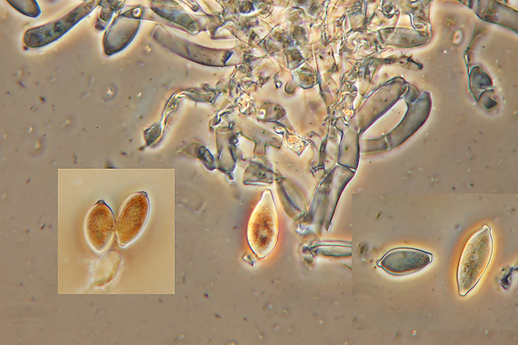 Botryobasidium aureum e il suo anamorfo Haplotrichum aureum